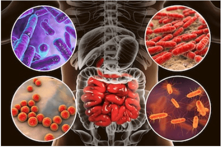 Nuovi probiotici contro la malattia di crohn